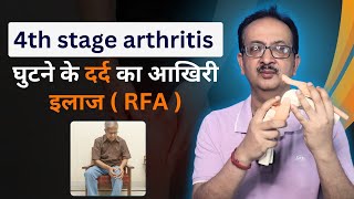 4th Stage Arthritis  कितना भी पुराना दर्द हो। घुटने के दर्द का आखिरी इलाज  ghutno ke dard ka ilaj [upl. by Eicram]