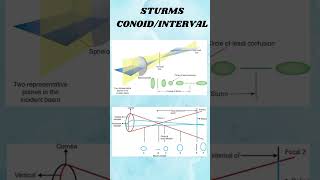 Astigmatism shortvideio viralshort ytshorts [upl. by Itsyrc181]