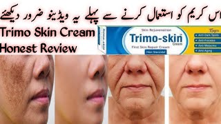 Trimo Skin Cream Honest Review Melasma treatment at Home Remove pigmentation  Sania Adnan Official [upl. by Omixam]