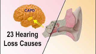 Hearing Loss Causes  23 Different Reasons Why Hearing Loss Occurs [upl. by May520]