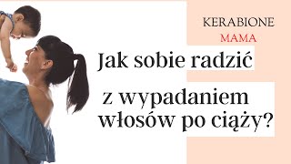 Kerabione Mama Jak sobie radzić z wypadaniem włosów po ciąży [upl. by Crenshaw]