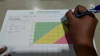 HOW TO PARTOGRAPH  LABOR MONITORING [upl. by Thomasin]