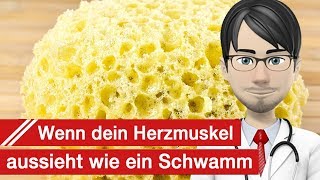 Der Herzmuskel sieht aus wie ein Schwamm Deutsches Zentrum für HerzKreislaufForschung über LVNC [upl. by Hafirahs]