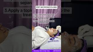 Transform Your Skin PRP Microneedling for Radiant Glow facecare akarshanclinic microneedling [upl. by Geldens420]