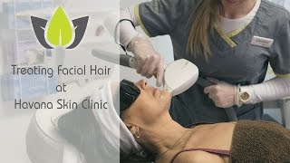 Laser hair removal face treatment  Havana Skin Clinic [upl. by Lupee]