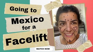 I went to Mexico for a Facelift [upl. by Notgnillew]