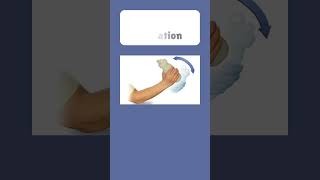 Boxers Fracture youtubeshorts youtube boxersfracture [upl. by Ahsiekahs]