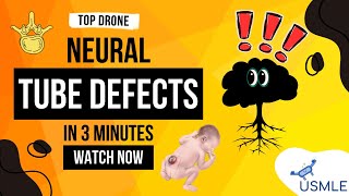 Neural Tube Defects in 3 Minutes [upl. by Nabru202]