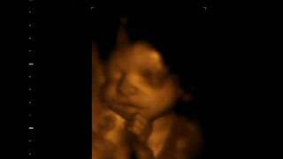 3D Ultrasound Session at 27 weeks amp 4 days [upl. by Harbed861]