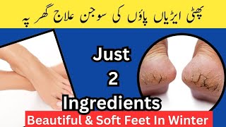 Crack Heels Treatment at Home پھٹی ایڑیاں بنائیں نرم و نازک اب گھر پہ [upl. by Tracey]