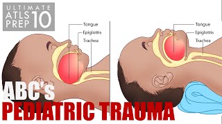 Ultimate ATLS 10 ABCs of Pediatric Trauma  Airway Management Anatomy amp Needle Cricothyrotomy [upl. by Sitruc]