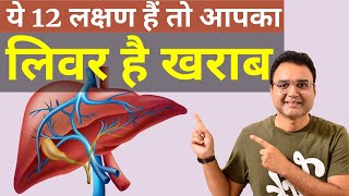 लिवर खराब होने के 12 शुरूआती लक्षण  Symptoms Of Liver Damage  by Dr Saleem Zaidi [upl. by Etnwahs]