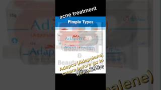 Acne treatment  Natural Remedies for Treating Acne  Effective Skincare Routine for AcneProne Skin [upl. by Hamford443]