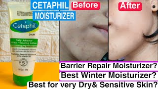 CETAPHIL Daily Advance Ultra Hydrating Lotion Review✅Best Winter Moisturizer For Dry Skin [upl. by Willabella]