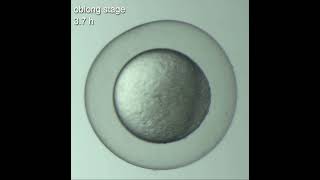 Onecellstage to 21somitestage development of a zebrafish embryo [upl. by Hwang425]