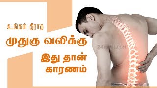 Causes of Lower Back Pain  Reasons medication treatment and home remedies  Tamil Health Tips [upl. by Zischke]