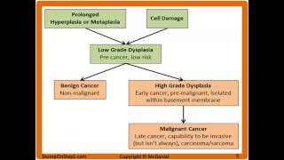 Difference between Benign and Malignant Dysplasia poorly differentiate well differentiated [upl. by Barvick]