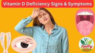 Vitamin D Deficiency Signs amp Symptoms [upl. by Mordy456]