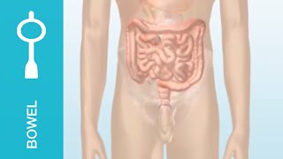 Bowel incontinence and chronic constipation [upl. by Nahsyar]