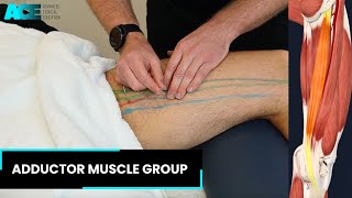 Dry Needling Adductor Muscle group [upl. by Ulphi740]