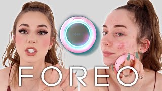 Foreo UFO 2 Review  Everything You Need to Know [upl. by Aicirtak188]