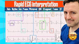 Rapid structured ECG interpretation A visual guide FOR REVISION electrocardiogram [upl. by Annoeik]