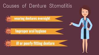 Denture Stomatitis Denture Sore mouth [upl. by Mossolb]