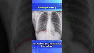 Chest X Ray PA view Normal Report  Positioning in Hindi [upl. by Zoara933]