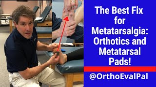 The Best Fix for Metatarsalgia Orthotics and Metatarsal Pads [upl. by Akirehc611]