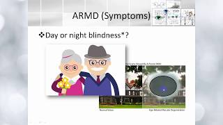 Elbromboly Basic ophthalmology IC Retina Retinal dystrophies and degeneration [upl. by Neffets733]