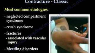 Volkmanns Ischemic Contracture Classic  Everything You Need To Know  Dr Nabil Ebraheim [upl. by Aihsyn]