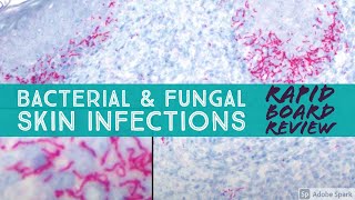 Infectious Dermpath bacterial amp fungal Board Review for Dermatology amp Pathology 20 cases [upl. by Hibben341]