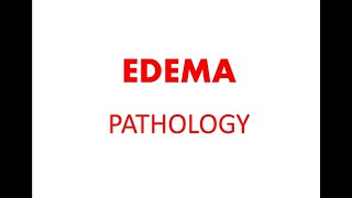 Edema in hindi for medical students pathology lecture [upl. by Eedia]