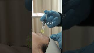 Exosome Skin Rejuvenation Treatment exosomes acnescars antiaging finelinesandwrinkles collagen [upl. by Ydarb]