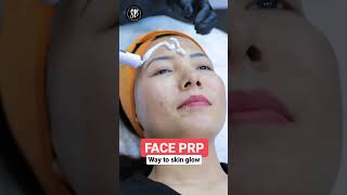 PRP treatment for face Way to skin glow prp prptreatment skinglow shorts youtubeshorts [upl. by Hahn]