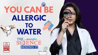 Can You Get Allergic to Water ll What Is The Science Behind Aquagenic Urticaria [upl. by Ttekcirc1]