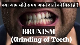 Bruxism or Grinding of Teeth Symptoms Causes and Treatment  How do you fix bruxism [upl. by Arette]