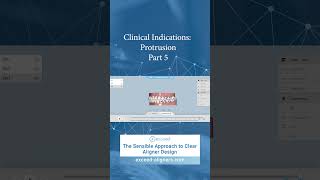 Clinical Indications Protrusion Part 5 [upl. by Aitnahc]