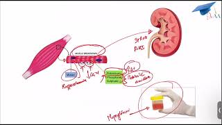 Rhabdomyolysis [upl. by Annahs]