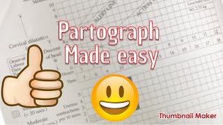 partograph made easy [upl. by Laspisa659]