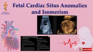 Fetal Cardiac Situs Anomalies and Isomerism [upl. by Nerdna]