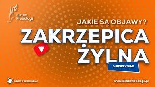 ZAKRZEPICA ŻYLNA  jakie są jej objawy [upl. by Aldo]