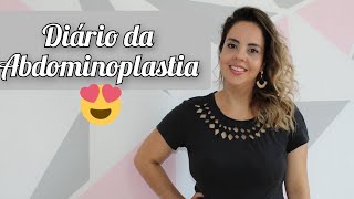 Abdominoplastia ❤️ PRIMEIRA CONSULTA COM VALORES ❤️ Cirurgia Plástica 1 [upl. by Corabelle]