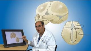 Craniosynostosis and its treatment  Boston Children’s Hospital [upl. by Nisay]