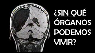 ¿SIN QUÉ ÓRGANOS PODEMOS VIVIR [upl. by Ursuline554]