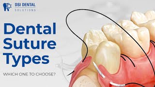 Dental Suture Types  which one to choose [upl. by Katalin]