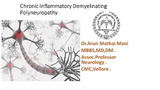 Chronic Inflammatory Demyelinating Polyneuropathy CIDP  DrArun Mathai CMC Vellore [upl. by Nnyroc]