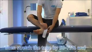 Shin Splints MTSS taping [upl. by Jaeger]