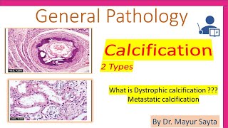 Pathological Calcification [upl. by Hoxsie880]