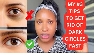 How To Get Rid Of Dark Circles Eyes Dark Circles Fast Remedies [upl. by Rawlinson]